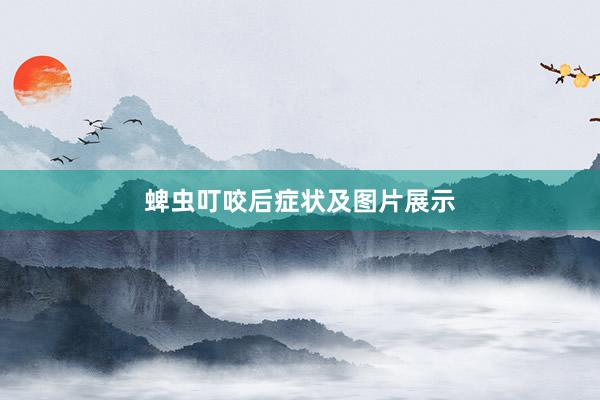 蜱虫叮咬后症状及图片展示